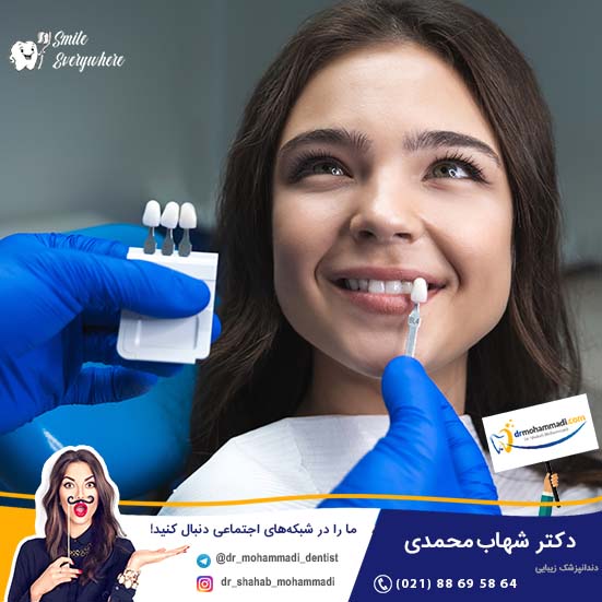 پیشرفت های اخیر لمینت ونیر در دندانپزشکی کدامند؟ - کلینیک دندانپزشکی دکتر شهاب محمدی
